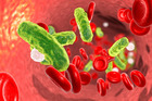 How Can Bloodstream Infections Be Prevented?